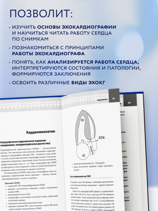 Эхокардиография для начинающих. Суть гемодинамических нарушений, позиции для анализа, определение тяжести порока. 2-е издание, исправленное и дополненное