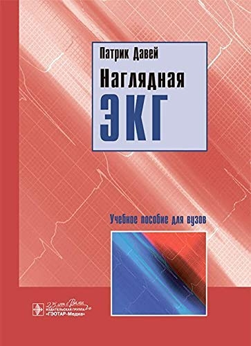 Наглядная ЭКГ