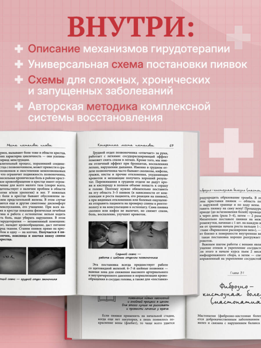 Лечение пиявками. Схемы гирудотерапии при сложных, хронических и запущенных заболеваниях