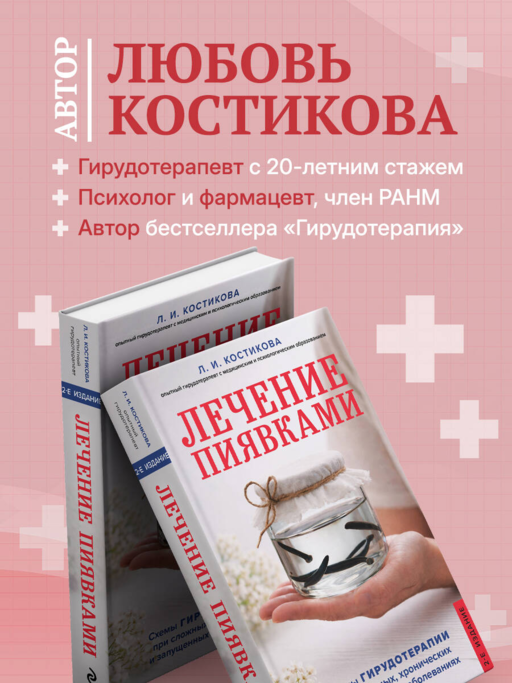 Лечение пиявками. Схемы гирудотерапии при сложных, хронических и запущенных заболеваниях